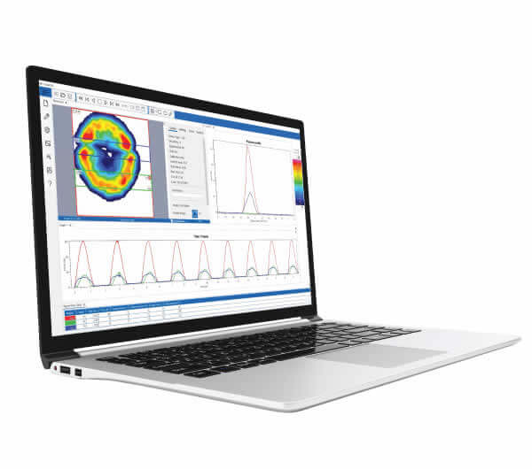 Versatible Software Analysis